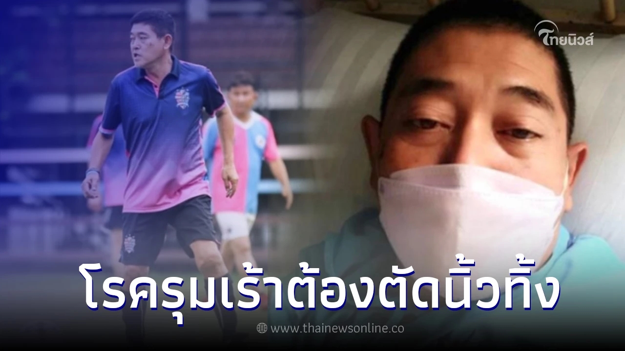 "สาธิต จึงสำราญ" อดีตทีมชาติไทย ป่วยหนักถึงขั้นต้องตัดนิ้วเท้าทิ้ง